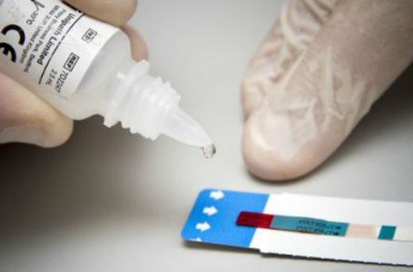 VIH: se descubren nuevos 61 casos a nivel nacional
