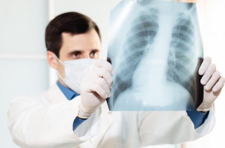 ¿Cómo una radiografía puede ayudar al diagnóstico de COVID-19?