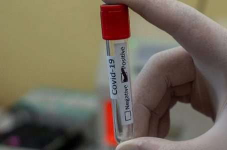 Especialistas aseguraron que eliminar barreras para realizarse exámenes PCR ayudará a disminuir contagios